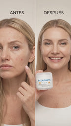CREMA ACLARANTE Y TRATAMIENTO FACIAL